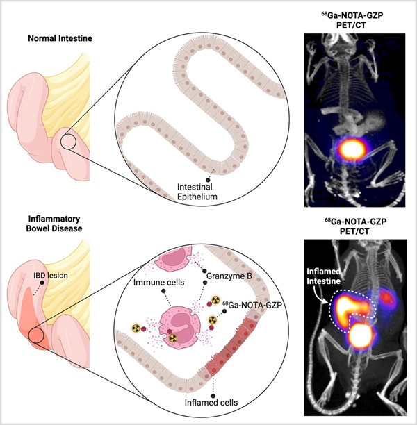 Image: Novel PET imaging tool identifies early signs of IBD and predicts response to treatment (Photo courtesy of Dr. P. Heidari and A. Hajmirazaian, et al, MGH) Image: Novel PET imaging tool identifies early signs of IBD and predicts response to treatment (Photo courtesy of Dr. P. Heidari and A. Hajmirazaian, et al, MGH)